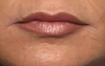 Lips